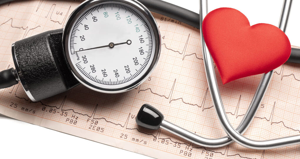 Nicardipina y su papel en la reducción de la presión arterial en Panamá